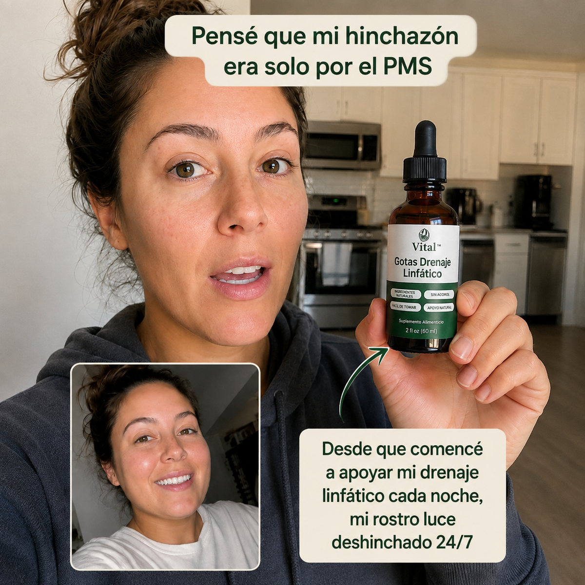 Vital| Reducí Hinchazon e Inflamación (Rostro, Abdomen y Piernas)